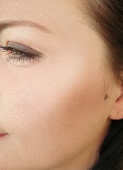 Photo après traitement Fatou S. (DUPL)