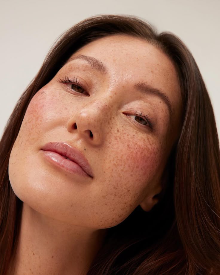 Photo avant traitement Fatou S. (DUPL)