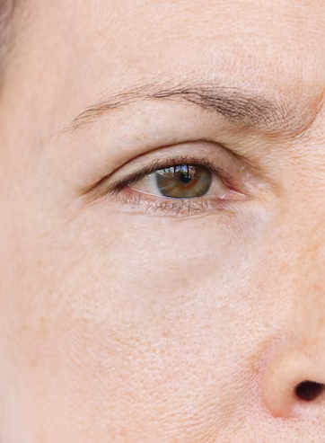 Photo après traitement Fatou S. (DUPL)